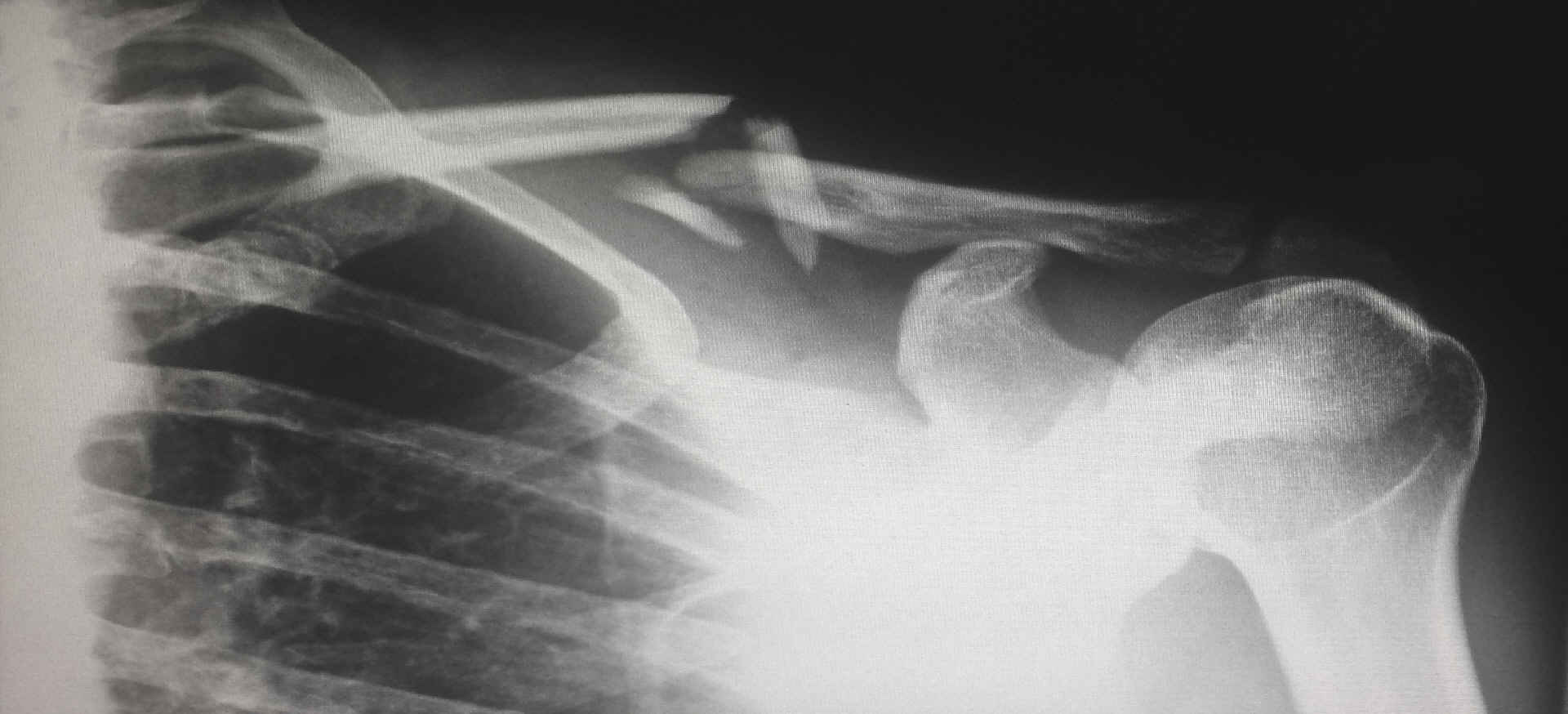 Radiology x-ray image
